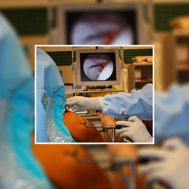 جراحی پارگی کپسول شانه در اتاق عمل