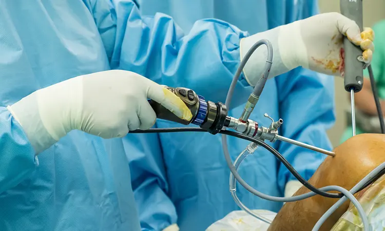 جراحی آرتروز شانه به روش آرتروسکوپی